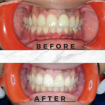 Slider image (4) Dr Feminath Ananthapuri Super Speciality Dental Clinic